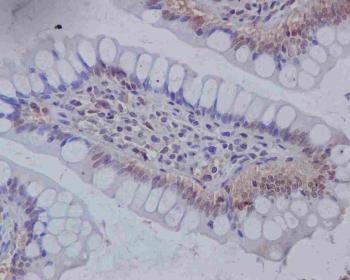 Immunohistochemical staining of FFPE human colon tissue using Musashi 1 antibody shows positive staining in epithelial cells within colonic crypts, consistent with reported Musashi 1 expression in intestinal progenitor populations.