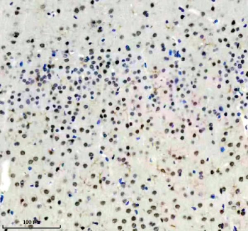 Immunohistochemical analysis of MSI1 using anti-MSI1 antibody. MSI1 is detected in a paraffin-embedded section of mouse brain tissue. Heat-mediated antigen retrieval was performed in EDTA buffer (pH 8.0). Positive nuclear and cytoplasmic staining is observed in a subset of brain cells, consistent with reported MSI1 expression patterns.