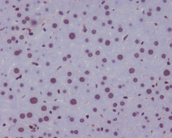 IHC staining of FFPE mouse liver tissue with KLF4 antibody. HIER: boil tissue sections in pH8 EDTA for 20 min and allow to cool before testing.