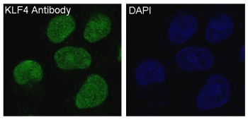 Immunofluorescent staining of FFPE human HeLa cells with KLF4 antibody (green) and DAPI nuclear stain (blue). HIER: steam section in pH6 citrate buffer for 20 min.