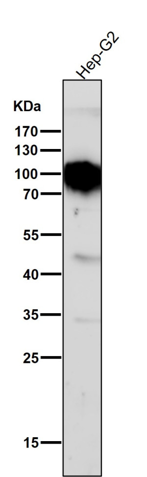 TGN46 Antibody Human Liver Cancer Cell WB. Western blot analysis of human HepG2 cell lysate using TGN46 Antibody / TGOLN2 (clone AOHO-20) at 1:1000 dilution. An HRP-conjugated secondary antibody with ECL substrate was used for detection. This recombinant rabbit monoclonal TGN46 Antibody detects a broad band at approximately 80-110 kDa, consistent with the expected migration pattern of highly glycosylated TGOLN2/TGN46 protein. Detection supports studies of trans-Golgi network structure, intracellular protein sorting, vesicle trafficking, and regulation of secretory pathway function.