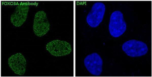 Forkhead Box O3 Antibody HeLa Cell IF. FOXO3A Antibody was used for immunofluorescent analysis of human HeLa cells. The antibody produced strong nuclear fluorescence (green), consistent with the localization of FOXO3A as a forkhead transcription factor that regulates genes involved in apoptosis, oxidative stress responses, and cell cycle control. Nuclei are counterstained with DAPI (blue). This Forkhead Box O3 Antibody / FOXO3A Antibody is well suited for investigating FOXO3A localization, transcription factor activity, PI3K/AKT signaling, and cellular stress response pathways.