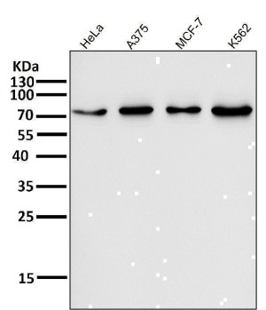 Forkhead Box O3 Antibody Human Cancer Cell WB. Western blot analysis was performed using FOXO3A Antibody on lane 1: human HeLa, lane 2: human A375, lane 3: human MCF-7, and lane 4: human K562 cell lysates. A distinct immunoreactive band is detected at approximately 71â90 kDa in all samples, consistent with the expected migration of FOXO3A, which commonly migrates above its predicted molecular weight due to glycosylation and other post-translational modifications. Expression across epithelial, melanoma, breast cancer, and leukemia cell lines demonstrates the broad distribution of this forkhead transcription factor. This Forkhead Box O3 Antibody / FOXO3A Antibody is well suited for Western blot studies of transcriptional regulation, PI3K/AKT signaling, apoptosis, oxidative stress responses, and cell fate determination.