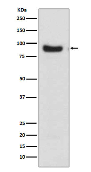 FOXO3A Antibody Human Breast Cancer Cell WB. Western blot analysis was performed using FOXO3A Antibody on human MCF-7 cell lysate. A distinct immunoreactive band is detected at approximately 80â90 kDa, consistent with the expected migration of FOXO3A, which commonly migrates above its predicted molecular weight due to post-translational modifications. The strong, specific signal demonstrates robust detection of endogenous FOXO3A in this breast cancer cell line. This FOXO3A Antibody / Forkhead Transcription Factor Antibody is well suited for Western blot studies of FOXO3A expression, transcriptional regulation, PI3K/AKT signaling, apoptosis, and cellular stress responses.