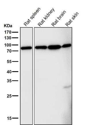 FOXO3A Antibody Rat Tissue WB. Western blot analysis was performed using FOXO3A Antibody on lane 1: rat spleen, lane 2: rat kidney, lane 3: rat brain, and lane 4: rat skin tissue lysates. A prominent immunoreactive band is detected at approximately 80â100 kDa in all tissues, consistent with the expected migration of FOXO3A, which commonly migrates above its predicted molecular weight due to post-translational modifications. Expression is observed across multiple rat tissues, demonstrating the broad distribution of this forkhead transcription factor. This FOXO3A Antibody / Forkhead Transcription Factor Antibody is well suited for Western blot studies of FOXO3A expression, transcriptional regulation, apoptosis, oxidative stress responses, and PI3K/AKT signaling.