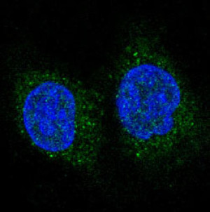 FOXO3A Antibody HeLa Cell IF. FOXO3A Antibody was used for immunofluorescent analysis of human HeLa cells. The antibody produced a distinct green fluorescent signal that is predominantly localized to the cytoplasm with additional nuclear staining, consistent with the dynamic intracellular distribution of FOXO3A regulated by phosphorylation and nucleo-cytoplasmic shuttling. Nuclei are counterstained with DAPI (blue). This FOXO3A Antibody / Forkhead Transcription Factor Antibody is well suited for investigating FOXO3A localization, transcription factor regulation, PI3K/AKT signaling, apoptosis, and cellular stress responses.