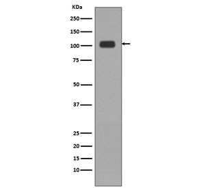 KDM1A / LSD1 Antibody HeLa WB. Western blot analysis of human HeLa cell lysate using KDM1A / LSD1 Antibody / Histone Demethylase. A prominent band is detected at approximately 110 kDa, consistent with the predicted molecular weight of Lysine-specific demethylase 1 / KDM1A, a chromatin-associated histone demethylase involved in epigenetic transcriptional regulation and chromatin remodeling pathways.