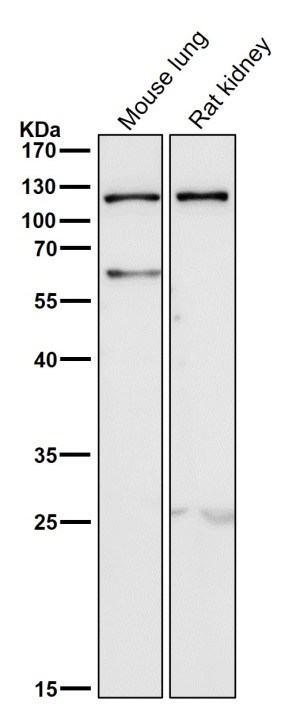 TLR5 Antibody Mouse Lung and Rat Kidney Tissue WB. Western blot analysis of mouse lung and rat kidney lysates using TLR5 Antibody clone AADF-20. Lane 1: mouse lung. Lane 2: rat kidney. A strong immunoreactive band is detected at approximately 115-120 kDa in both tissue lysates, consistent with the mature glycosylated form of TLR5. Although the predicted molecular weight of the TLR5 polypeptide is approximately 98 kDa, N-linked glycosylation commonly results in slower electrophoretic migration and an apparent molecular weight of approximately 110-120 kDa. These results demonstrate that this TLR5 Antibody, a Flagellin Receptor Antibody, specifically detects endogenous TLR5 in rodent tissues by Western blot.