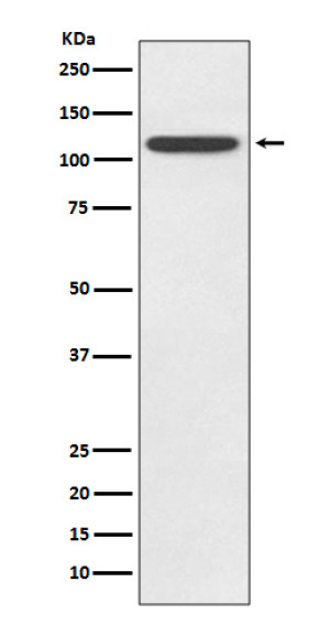 TLR5 Antibody HeLa Cell WB. Western blot analysis of human HeLa cell lysate using TLR5 Antibody clone AADF-20. A single prominent band is detected at approximately 98 kDa, consistent with the expected molecular weight of TLR5. The clean, specific immunoreactive band demonstrates endogenous expression of TLR5 in HeLa cells and supports the antibody's specificity for this membrane-associated pattern recognition receptor. These results demonstrate that this TLR5 Antibody, a Flagellin Receptor Antibody, is suitable for detecting endogenous TLR5 by Western blot.