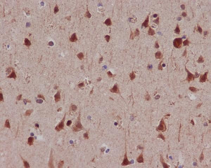 Phospho-MSK1 (S376) Antibody Rat Brain IHC. Immunohistochemistry analysis of paraffin-embedded rat brain tissue using Phospho-MSK1 (S376) Antibody. Heat induced antigen retrieval was performed prior to staining. Strong nuclear staining is observed in neurons throughout the brain, consistent with phosphorylation of MSK1 at serine 376 following activation of MAPK signaling pathways. These results support the use of Phospho-MSK1 (S376) Antibody for studying activated MSK1, neuronal signal transduction and phosphorylation-dependent cellular responses.