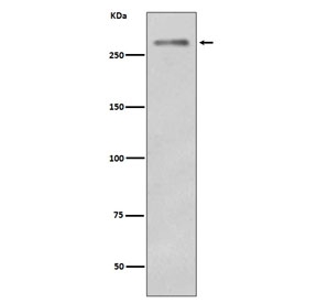 Dysferlin Antibody Skeletal Muscle WB. Western blot analysis of mouse skeletal muscle lysate using Dysferlin Antibody / Muscle Membrane Repair Protein clone EGO-4. A distinct band is detected at approximately 260-270 kDa, corresponding to Dysferlin / DYSF. The observed molecular weight is slightly higher than the predicted molecular weight of approximately 237 kDa, a finding that can occur with large membrane-associated proteins. Dysferlin is a ferlin family protein that plays a critical role in calcium-dependent sarcolemmal repair and maintenance of muscle fiber integrity. The strong signal observed in skeletal muscle is consistent with the established expression of Dysferlin in contractile tissues that undergo repeated mechanical stress and membrane remodeling.
