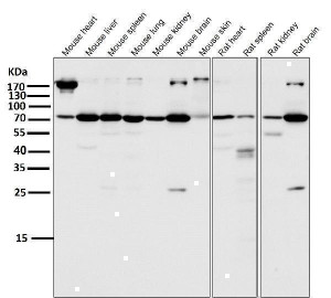 ATG7 Antibody Mouse and Rat Tissue WB. Western blot analysis was performed using ATG7 Antibody on mouse heart, mouse liver, mouse spleen, mouse lung, mouse kidney, mouse brain, mouse skin, rat heart, rat spleen, rat kidney, and rat brain tissue lysates. A prominent immunoreactive band is detected at approximately 78 kDa in all examined tissues, consistent with the expected molecular weight of ATG7. Differences in band intensity reflect tissue-specific expression levels, while additional higher or lower molecular weight bands may represent isoforms, post-translationally modified species, or nonspecific reactivity. These results demonstrate that this Knockout Validated Antibody is suitable for Western blot detection of ATG7 in mouse and rat tissues.