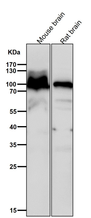 AP2A1 Antibody Mouse and Rat Brain WB. Western blot testing of mouse brain and rat brain lysates with AP2A1 Antibody at 1:6000 dilution. Samples were incubated with AP2A1 antibody for 1 hour at room temperature. A major band was detected at approximately 100 kDa, consistent with the expected molecular weight of AP2A1. AP2A1 Antibody supports detection of alpha adaptin expression and studies of adaptor protein complex function, clathrin-mediated endocytosis, membrane trafficking and intracellular transport pathways.