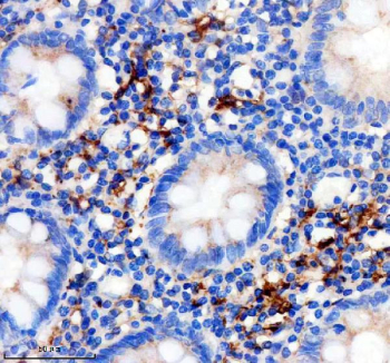 Immunohistochemistry of Factor XIIIa antibody in human appendix. FFPE human appendix tissue was stained with Factor XIIIa antibody rabbit monoclonal clone ACGC-6. Cytoplasmic HRP-DAB brown staining is observed in scattered stromal and lamina propria histiocytic cells within the appendiceal mucosa, consistent with known Factor XIII A chain expression in tissue macrophages and dendritic cells. Glandular epithelial cells show minimal to absent staining. Heat induced epitope retrieval was performed by boiling tissue sections in pH 8 EDTA buffer for 20 minutes followed by cooling prior to antibody incubation.