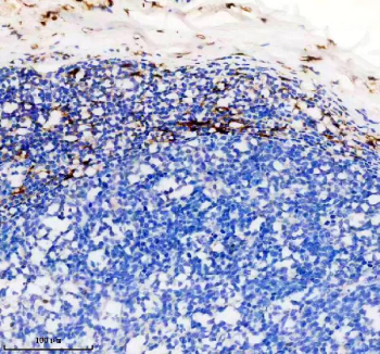 IHC staining of FFPE human appendix tissue with Factor XIIIa antibody, HRP-secondary and DAB substrate. HIER: boil tissue sections in pH8 EDTA for 20 min and allow to cool before testing.