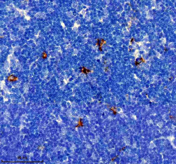 IHC staining of FFPE rat thymus tissue with Factor XIIIa antibody, HRP-secondary and DAB substrate. HIER: boil tissue sections in pH8 EDTA for 20 min and allow to cool before testing.