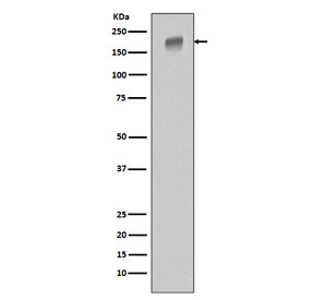 EGFR Antibody WB. Western blot testing of human HeLa cell lysate with EGFR antibody. Expected molecular weight: 134-170 kDa depending on glycosylation level.
