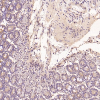 EGFR Antibody Mouse Intestine IHC. Immunohistochemistry staining of FFPE mouse intestine tissue with EGFR antibody. HIER: boil tissue sections in pH6, 10mM citrate buffer, for 10-20 min and allow to cool before testing.