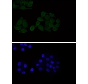 EGFR Antibody HeLa IF. Immunofluorescent staining of FFPE human HeLa cells with EGFR antibody at 1:50 dilution (green) and DAPI nuclear stain (blue). HIER: steam section in pH6 citrate buffer for 20 min.