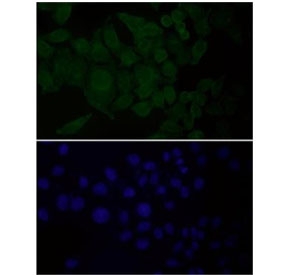 EGFR Antibody FFPE HeLa Cell IF. Immunofluorescent staining of FFPE human HeLa cells with EGFR antibody at 1:150 dilution (green) and DAPI nuclear stain (blue). HIER: steam section in pH6 citrate buffer for 20 min.