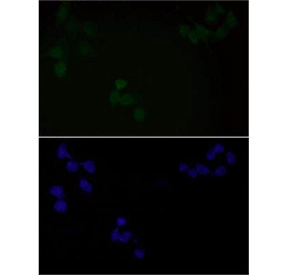 Immunofluorescent staining of FFPE human HeLa cells with Phospho-EGF Receptor antibody (green) and DAPI nuclear stain (blue). HIER: steam section in pH6 citrate buffer for 20 min.