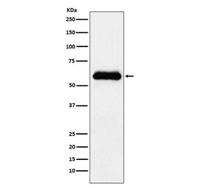 SERPINA3 Antibody Plasma WB. Western blot analysis of Alpha-1-antichymotrypsin / SERPINA3 in human plasma lysate using recombinant rabbit monoclonal SERPINA3 antibody, clone ADED-19. A prominent band is observed at approximately 50â65 kDa, consistent with the predicted molecular weight of SERPINA3 and its known glycosylated forms, while the lower end of this range may represent less modified protein species. This migration pattern reflects variable glycosylation of this secreted plasma protein, a feature commonly reported for Alpha-1-antichymotrypsin in western blot analysis.