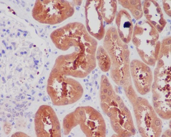 NGF Antibody Kidney IHC. Immunohistochemistry staining of FFPE human kidney tissue with NGF Antibody / Neurotrophin Signaling Marker Antibody. HIER: boil tissue sections in pH6, 10mM citrate buffer, for 10-20 min and allow to cool before testing.