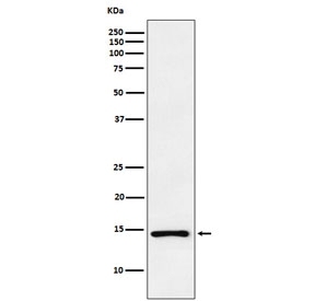 Atrial Natriuretic Peptide Antibody PC-3 WB. Western blot analysis of human PC-3 cell lysate using Atrial Natriuretic Peptide antibody demonstrates a distinct immunoreactive band at approximately 15-17 kDa, consistent with the expected molecular weight of Atrial Natriuretic Peptide (ANP/ANF). ANP is a peptide hormone encoded by the NPPA gene that functions as an important regulator of cardiovascular homeostasis, fluid balance, and natriuretic peptide signaling. The detected band supports expression of ANP-associated protein in human cells and demonstrates the utility of this antibody for studies of cardiac hormone biology, endocrine signaling pathways, and natriuretic peptide regulation. Predicted molecular weight: ~17 kDa.
