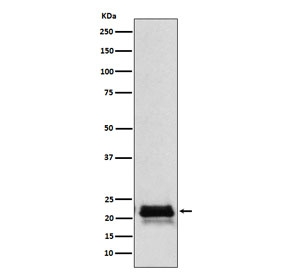 FSH beta Antibody Pituitary WB. Western blot testing of human pituitary lysate with FSH beta antibody. Expected molecular weight: 17-23 kDa depending on level of glycosylation.
