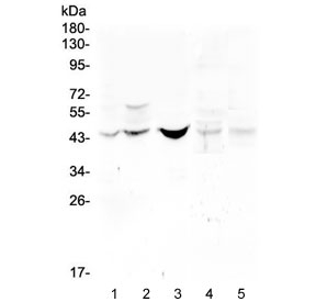 Western blot testing of 1) human HeLa, 2) human placenta, 3) human Caco-2, 4) rat lung and 5 mouse lung lysate with BPM15 antibody at 0.5ug/ml.Routinely observed molecular weight: ~50 kDa pro form and 16-17 kDa mature form.