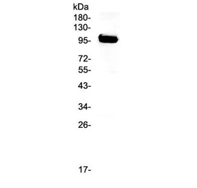 Western blot testing of human T-47D cell lysate with APP antibody at 0.5ug/ml. Expected molecular weight 79~120 kDa depending on glycosylation level.