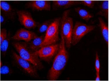 Keratin 8 Antibody U-2 OS Cell IF. Immunofluorescent staining of FFPE U-2 OS cells using Keratin 8 Antibody demonstrates distinct red cytoplasmic staining consistent with expression of Cytokeratin 8 (CK8/KRT8), a type II intermediate filament protein involved in epithelial cytoskeletal organization and cellular structural integrity. The staining pattern highlights the filamentous cytoplasmic distribution characteristic of intermediate filament proteins, while DAPI (blue) counterstains cell nuclei. This image demonstrates intracellular localization of CK8 and supports the utility of the antibody for immunofluorescence applications. HIER: steam tissue sections in pH 6 citrate buffer for 20 minutes prior to staining.