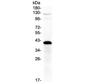 HSD17B1 Antibody Placenta WB. Western blot testing of human placenta lysate with HSD17B1 antibody at 0.5ug/ml. Predicted molecular weight ~35 kDa.