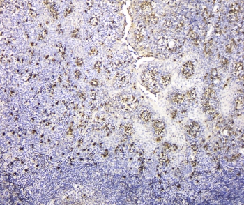 IHC staining of FFPE human tonsil tissue with IGLL1 antibody at 1ug/ml. HIER: boil tissue sections in pH6, 10mM citrate buffer, for 10-20 min and allow to cool before testing.