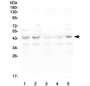 Western blot testing of human 1) HeLa, 2) K562, 3) PC-3, 4) A549 and 5) T-47D lysate with CCR10 antibody at 0.5ug/ml. Predicted molecular weight ~38 kDa.