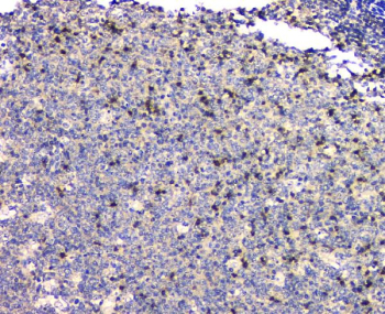 IHC staining of FFPE human tonsil tissue with PTPN11 antibody, HRP-secondary and DAB substrate. HIER: boil tissue sections in pH8 EDTA for 20 min and allow to cool before testing.