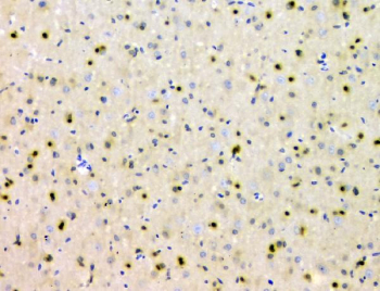 IHC staining of FFPE rat brain tissue with PTPN11 antibody, HRP-secondary and DAB substrate. HIER: boil tissue sections in pH8 EDTA for 20 min and allow to cool before testing.