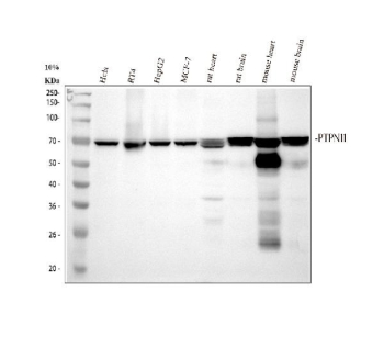 Western blot analysis of SHP2 (PTPN11) expression in human, rat, and mouse samples. Whole cell lysates and tissue lysates were separated by SDS-PAGE under reducing conditions and probed with anti-SHP2/PTPN11 antibody. Lane 1: human HeLa whole cell lysates; Lane 2: human RT4 whole cell lysates; Lane 3: human HepG2 whole cell lysates; Lane 4: human MCF-7 whole cell lysates; Lane 5: rat heart tissue lysates; Lane 6: rat brain tissue lysates; Lane 7: mouse heart tissue lysates; Lane 8: mouse brain tissue lysates. A prominent band is detected at approximately 68 kDa, consistent with the predicted molecular weight of SHP2 based on its amino acid sequence. Stronger signal is observed in brain tissue lysates compared to heart tissue lysates, consistent with expected stronger expression of SHP2 in neural tissues.