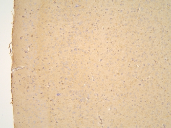 IHC staining of FFPE mouse brain with PPA1 antibody at 1ug/ml. HIER: boil tissue sections in pH6, 10mM citrate buffer, for 10-20 min and allow to cool before testing.