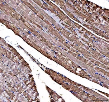 IHC staining of FFPE human skeletal muscle tissue with DOK7 antibody. HIER: boil tissue sections in pH8 EDTA for 20 min and allow to cool before testing.