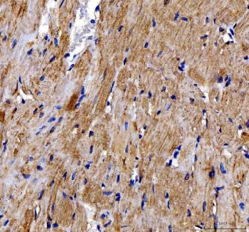 IHC staining of FFPE rat heart tissue with DOK7 antibody. HIER: boil tissue sections in pH8 EDTA for 20 min and allow to cool before testing.