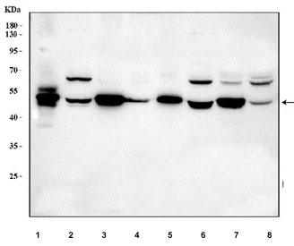 Western blot testing of 1) rat skeletal muscle, 2) rat brain, 3) rat heart, 4) rat L6, 5) mouse skeletal muscle, 6) mouse brain, 7) mouse heart and 8) mouse C2C12 cell lysate with DOK7 antibody. Predicted molecular weight ~53 kDa.