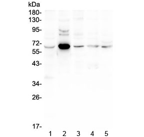 Western blot testing of 1) rat liver, 2) mouse thymus, 3) mouse lung, 4) mouse liver and 5) mouse SP2/0 lysate with EGFL6 antibody at 0.5ug/ml. Predicted molecular weight ~62 kDa.