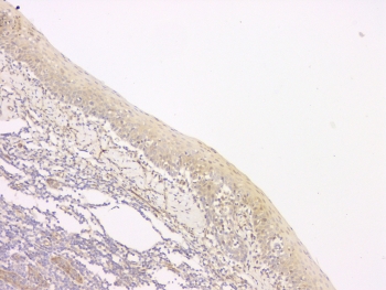 IHC staining of FFPE human tonsil with SRCIN1 antibody at 1ug/ml. HIER: boil tissue sections in pH6, 10mM citrate buffer, for 10-20 min and allow to cool before testing.