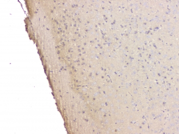IHC staining of FFPE mouse brain with SRCIN1 antibody at 1ug/ml. HIER: boil tissue sections in pH6, 10mM citrate buffer, for 10-20 min and allow to cool before testing.