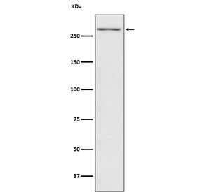 TG Antibody for WB. Western blot analysis using TG Antibody for WB (clone AFEI-20) in human thyroid tissue lysate. Lane 1: human thyroid lysate. A band is detected at approximately 300 kDa, consistent with the predicted molecular weight of Thyroglobulin (TG), a large glycosylated thyroid hormone precursor protein produced by thyroid follicular epithelial cells.