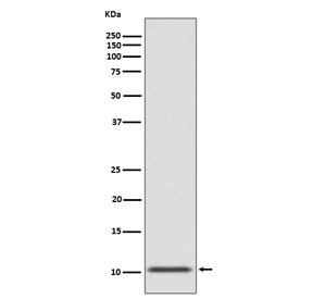 Western blot testing of human fetal pancreas with GLP-1 antibody. Predicted molecular weight ~3 kDa but can be observed at up to ~21 kDa depending on Proglucagon cleavage.