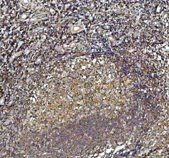 IHC staining of FFPE human tonsil with ARPC1B antibody. HIER: boil tissue sections in pH8 EDTA for 20 min and allow to cool before testing.