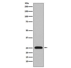 Western blot testing of human plasma lysate with Lambda light chain antibody. Predicted molecular weight: 22-25 kDa.