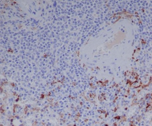 IGHG1 Antibody Human Spleen IHC. Immunohistochemistry was performed on paraffin-embedded human spleen tissue using IGHG1 Antibody. Strong cytoplasmic staining is observed in scattered plasma cells within the splenic tissue, while the surrounding lymphoid cell population exhibits minimal background staining. This staining pattern is consistent with the expected expression of human IgG1 in antibody-producing plasma cells. These results demonstrate that this Human IgG Antibody is suitable for immunohistochemical detection of IGHG1 in formalin-fixed, paraffin-embedded human tissues.